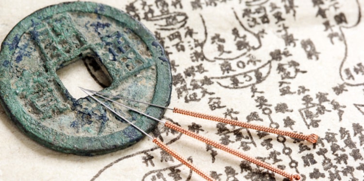 Where Does Acupuncture Come From?