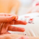 pregnant woman at acupuncturist
