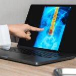 Hand emerging from a white lab coat sleeve points to an image of a spine in a laptop screen.