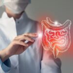 A medical professional points to a graphic image of an inflamed intestine.