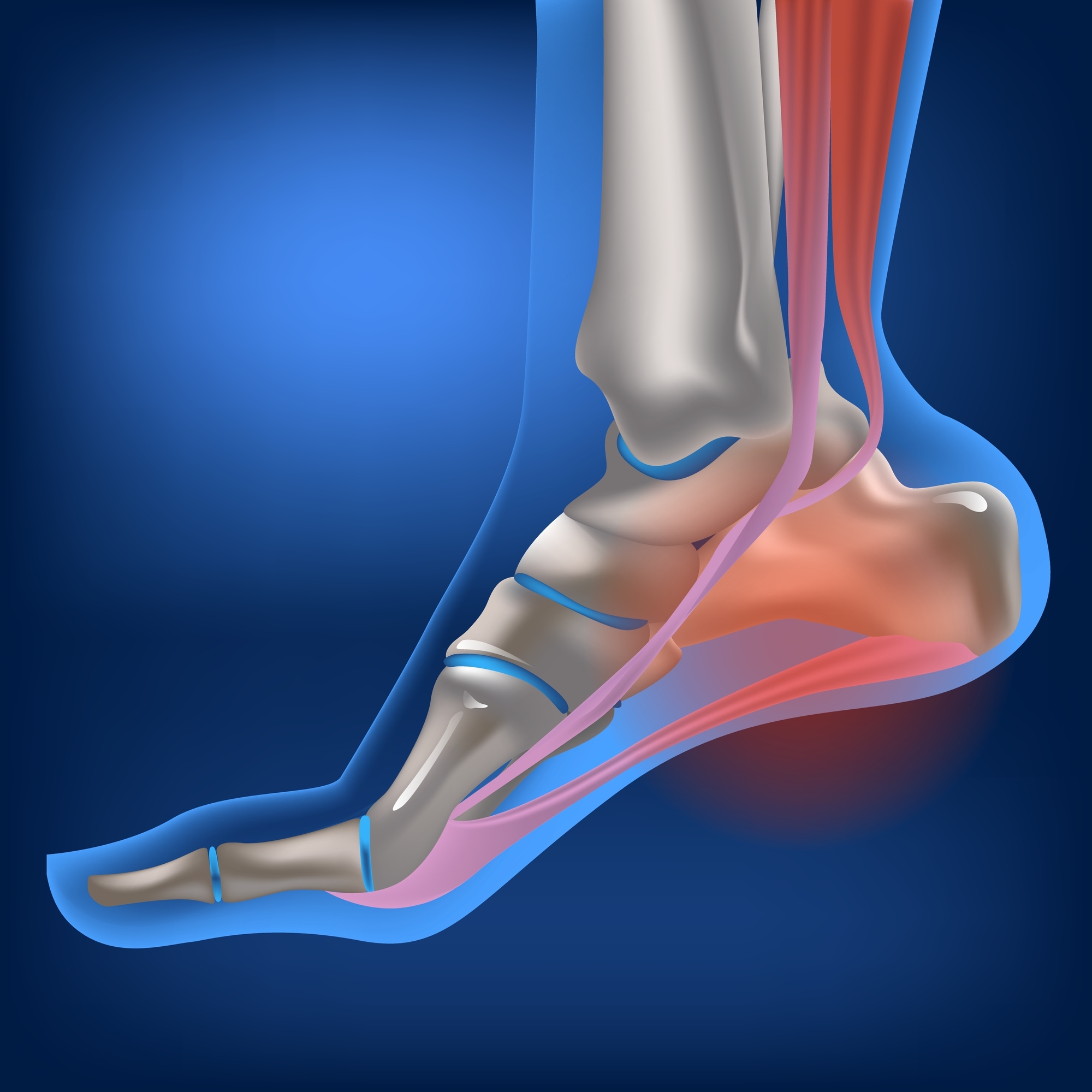 A transparent foot showing the plantar fascia and bones