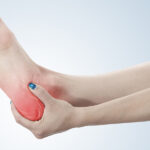 chiropractor for ankle sprain